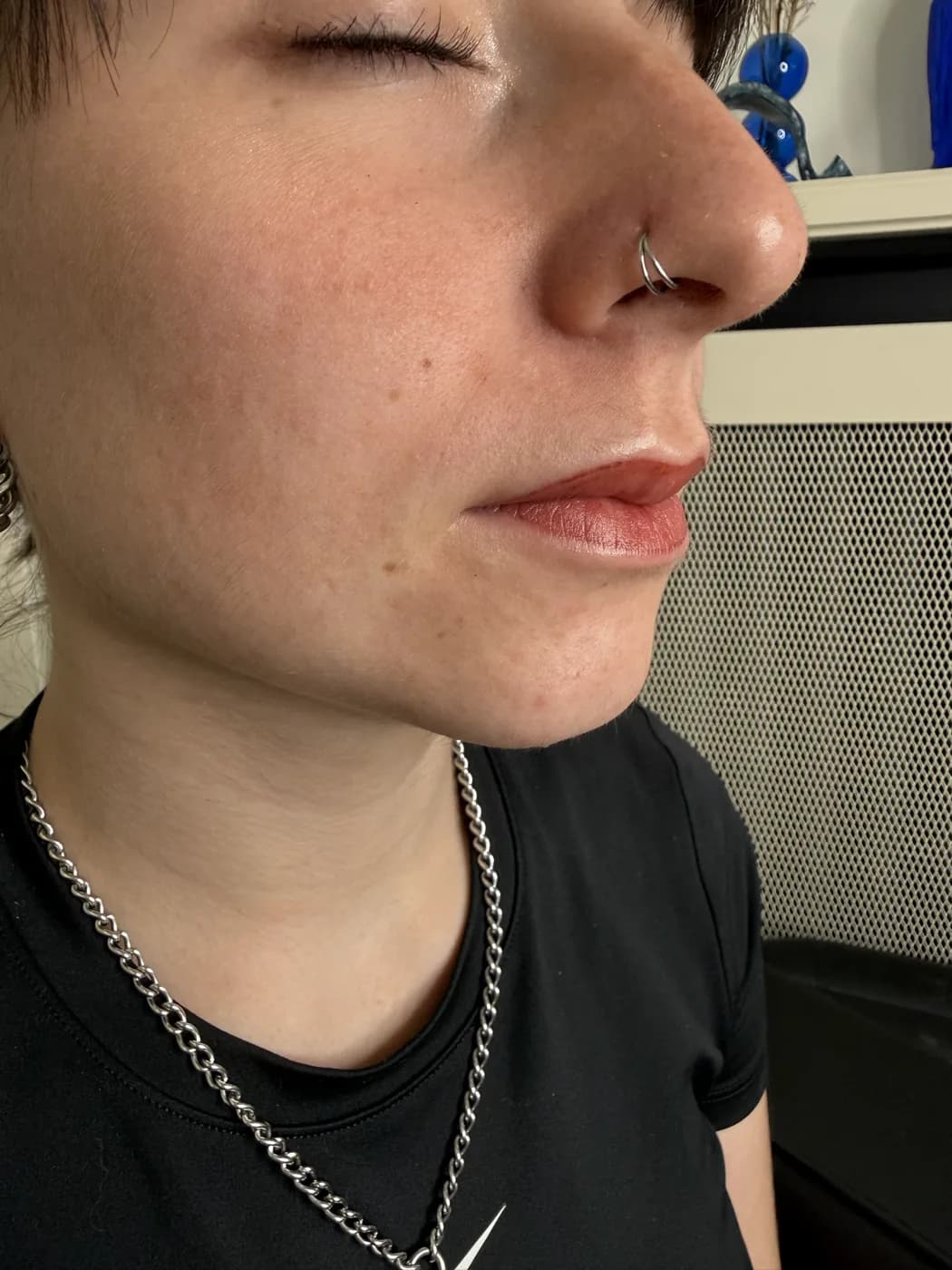 Résultat d’une dermopigmentation des lèvres, exemple 2