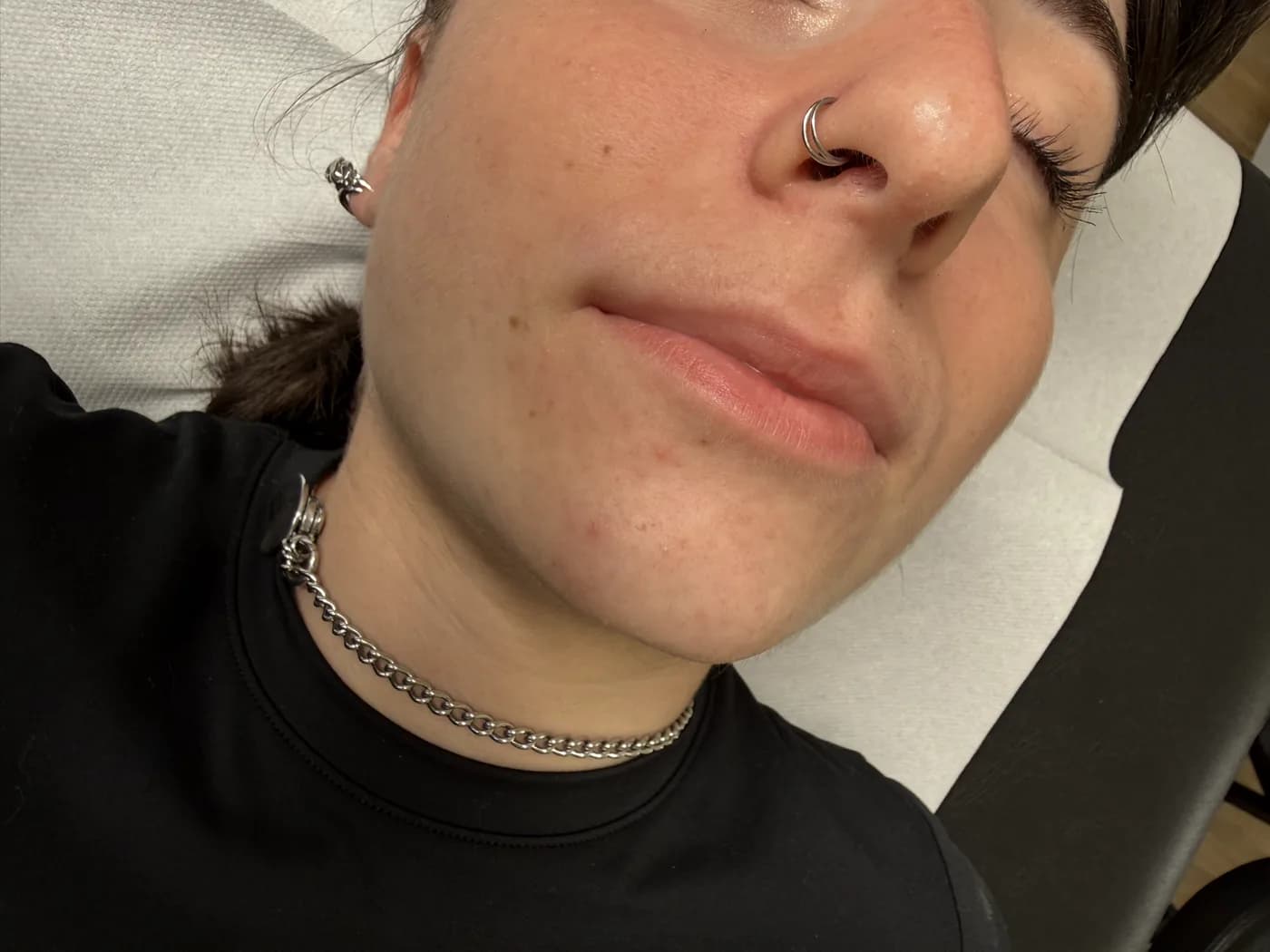 Résultat d’une dermopigmentation des lèvres, exemple 3
