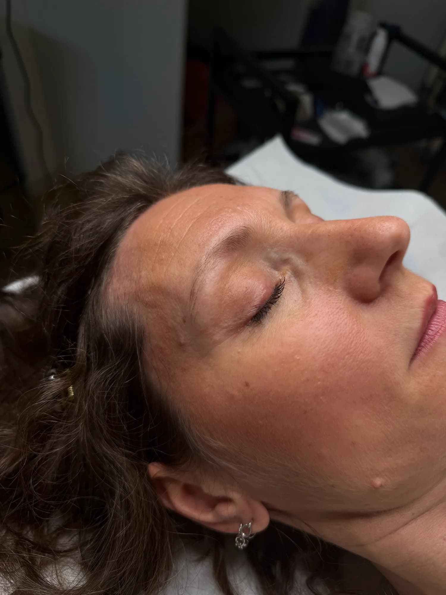 Reconstruction des sourcils, début de séance, accompagnée avec douceur